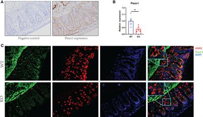 Reprogrammed fecal and mucosa-associated intestinal microbiota and weakened mucus layer in intestinal goblet cell- specific Piezo1-deficient mice